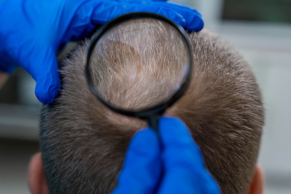 An image of someone using a magnifying glass examining hair.