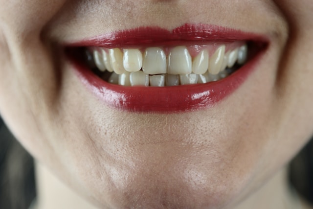 An image of a woman with a crooked smile and discolored teeth.