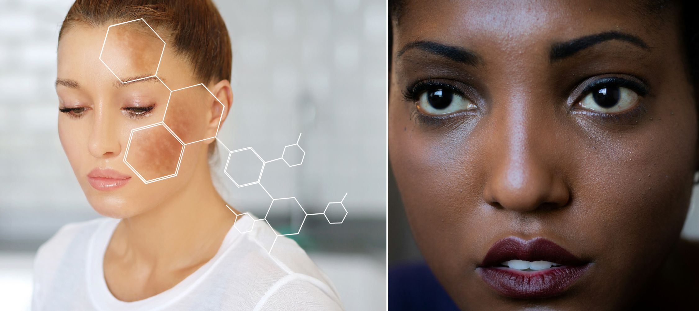 Viral K Beauty Brand ANUA Skincare is Fighting Hyperpigmentation and Serving Glass Skin